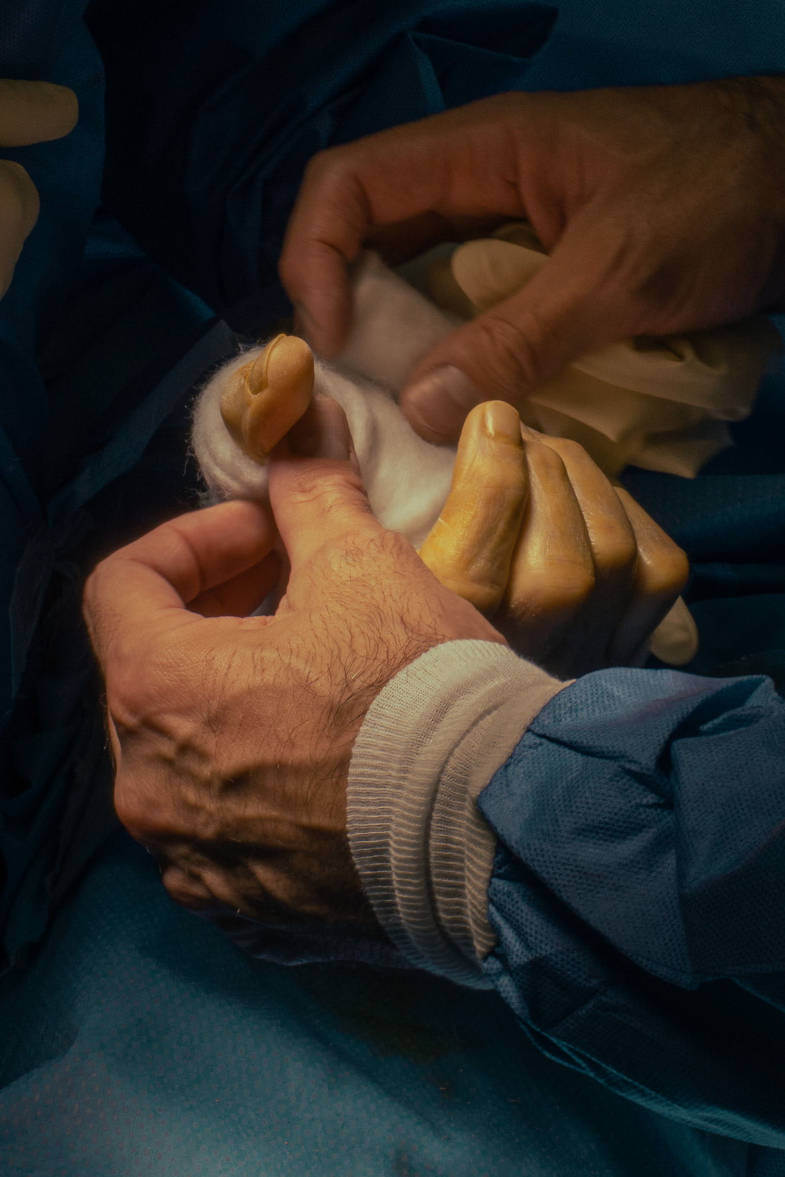 3 months in a surgery room.